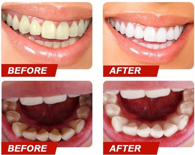 Dentifrice Blanchissant