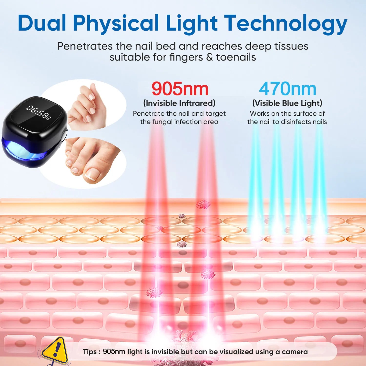 Dispositif de Traitement Laser pour Infections Fongiques