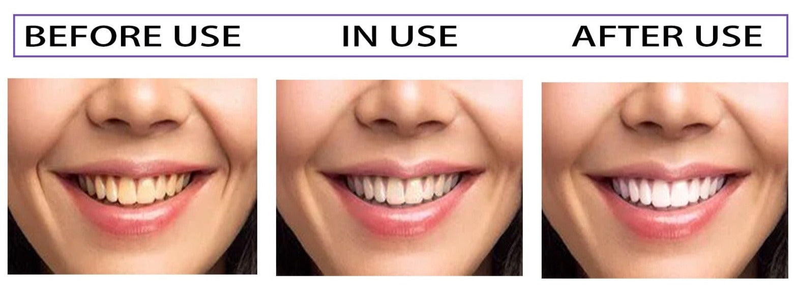 Dentifrice Blanchissant