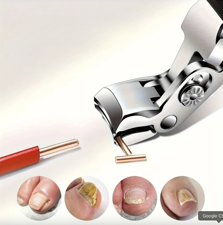 Ensemble de Coupe-ongles pour Ongles Incarnés - 4PCS