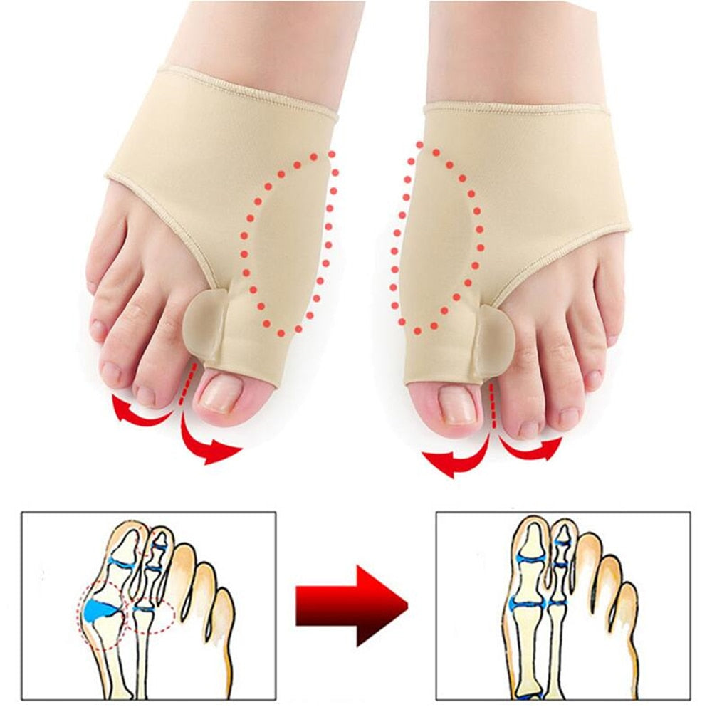 Paire correctrice pour hallux valgus