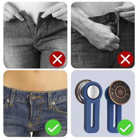 Lot de 10 Boutons de jeans rétractables