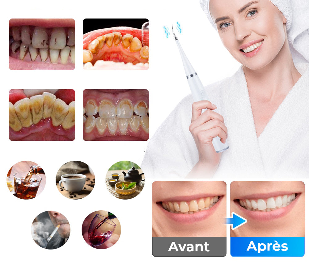 Kit Dentaire Électrique + Accessoires
