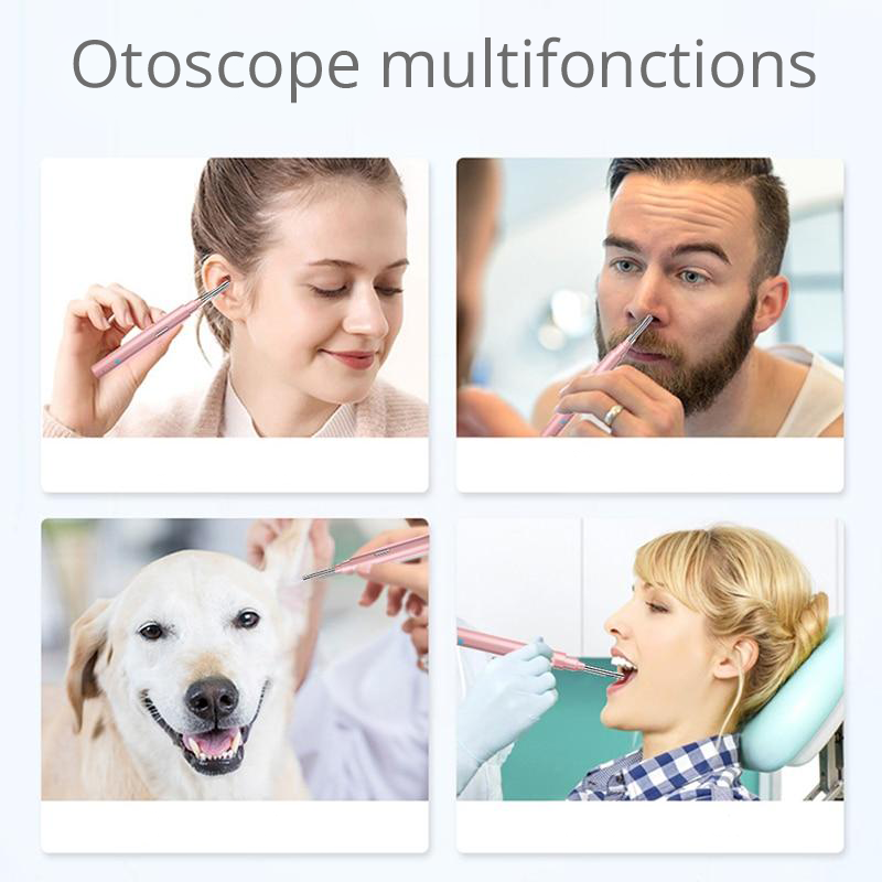 caméra-otoscope-nettoyage-oreille