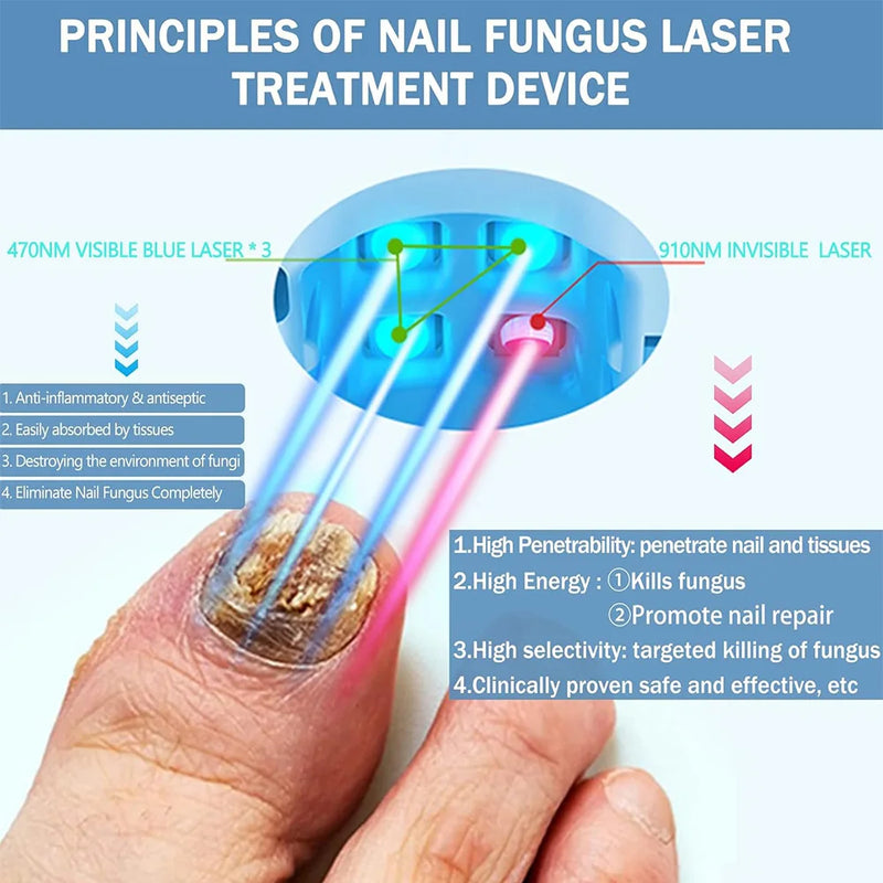 Appareil de Traitement au Laser pour Champignons des Ongles