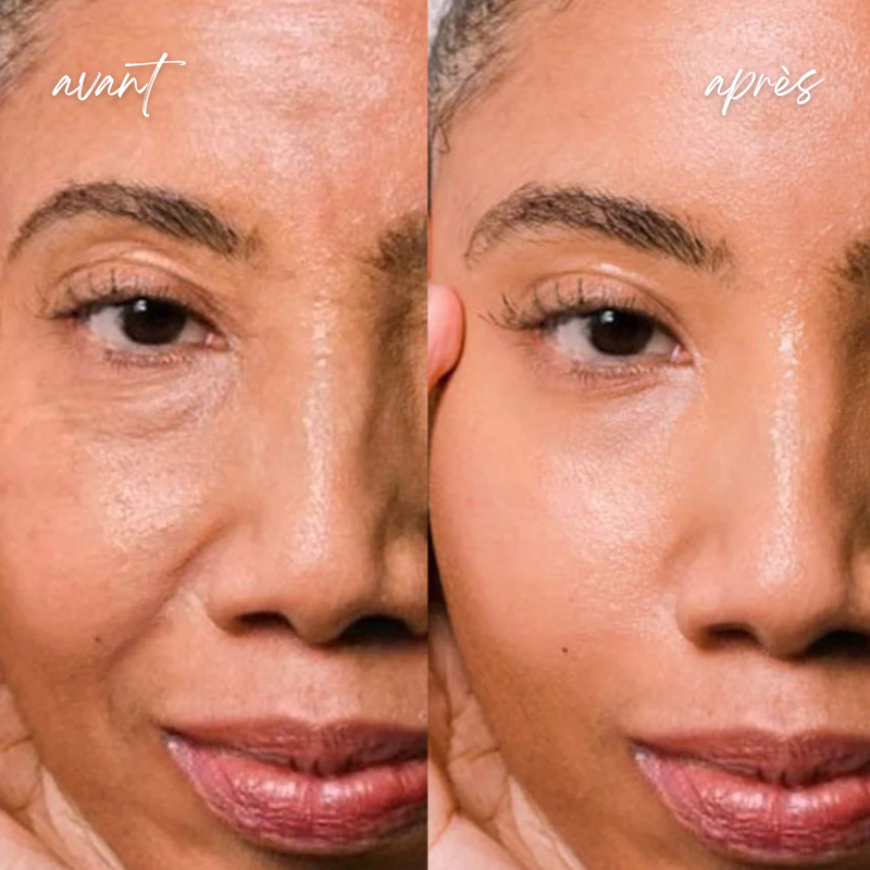 Sérum Visage 5 en 1 : Hyaluronique, Nicotinamide, Vitamine C et E & Collagène