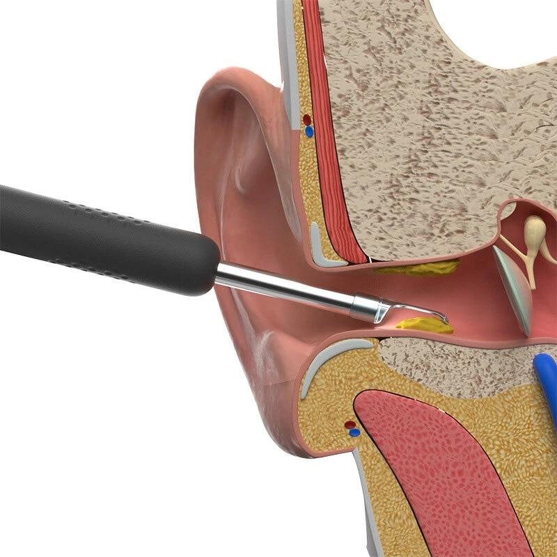 Nettoyeur d'oreilles avec caméra intégrée