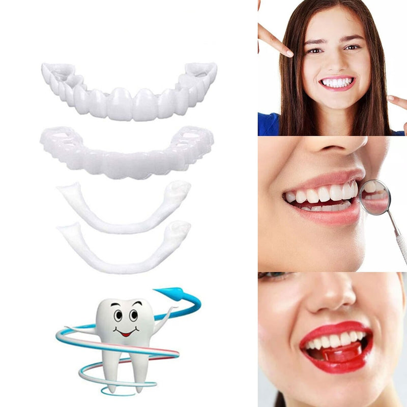 Facettes Dentaires